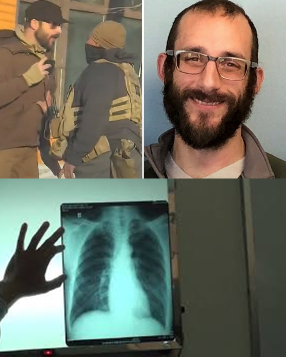 BREAKING NEWS: Nurse Alex Pretti suffered serious injuries in a confrontation with federal agents a week before his death, details as follows…