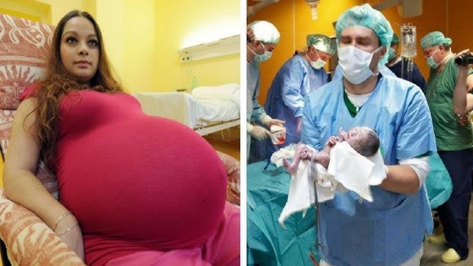 She Thought It Was Twins — Then Doctors Froze When They Realized This Birth Was UNPRECEDENTED