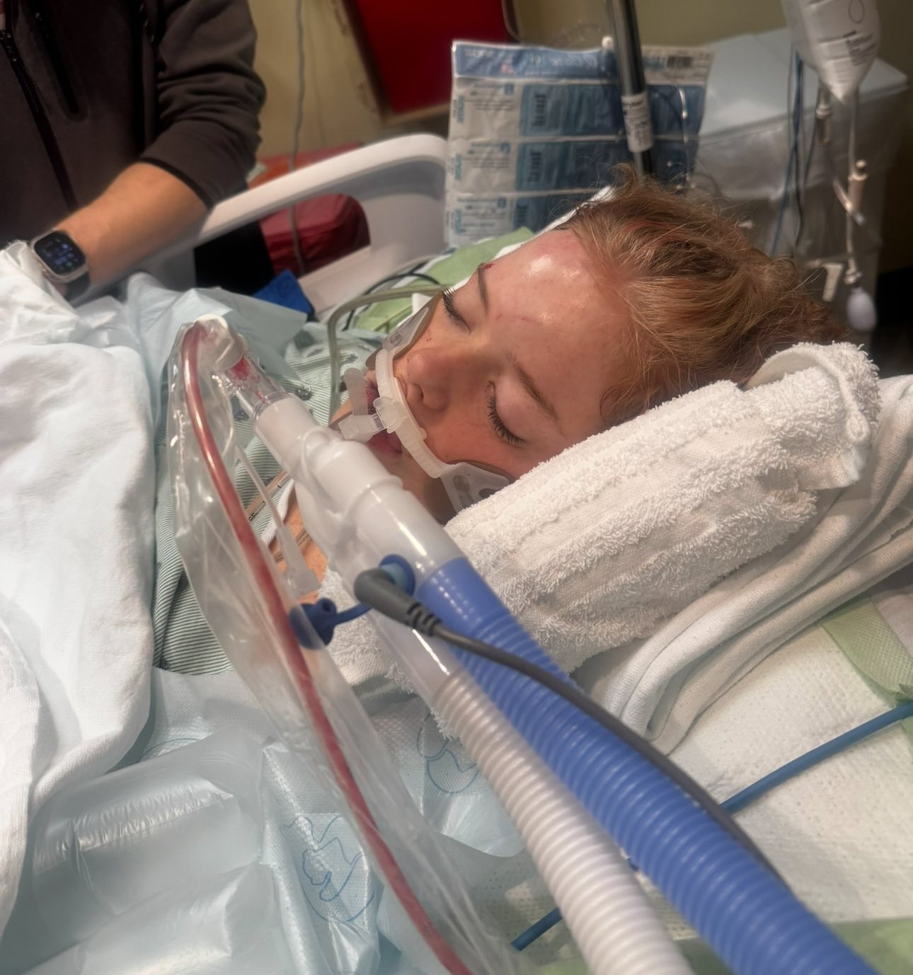 Forty Days Later: Physicians Announce a Concerning Discovery in Dilynn Turner’s Brain as She Continues to Fight for Recovery… 👇