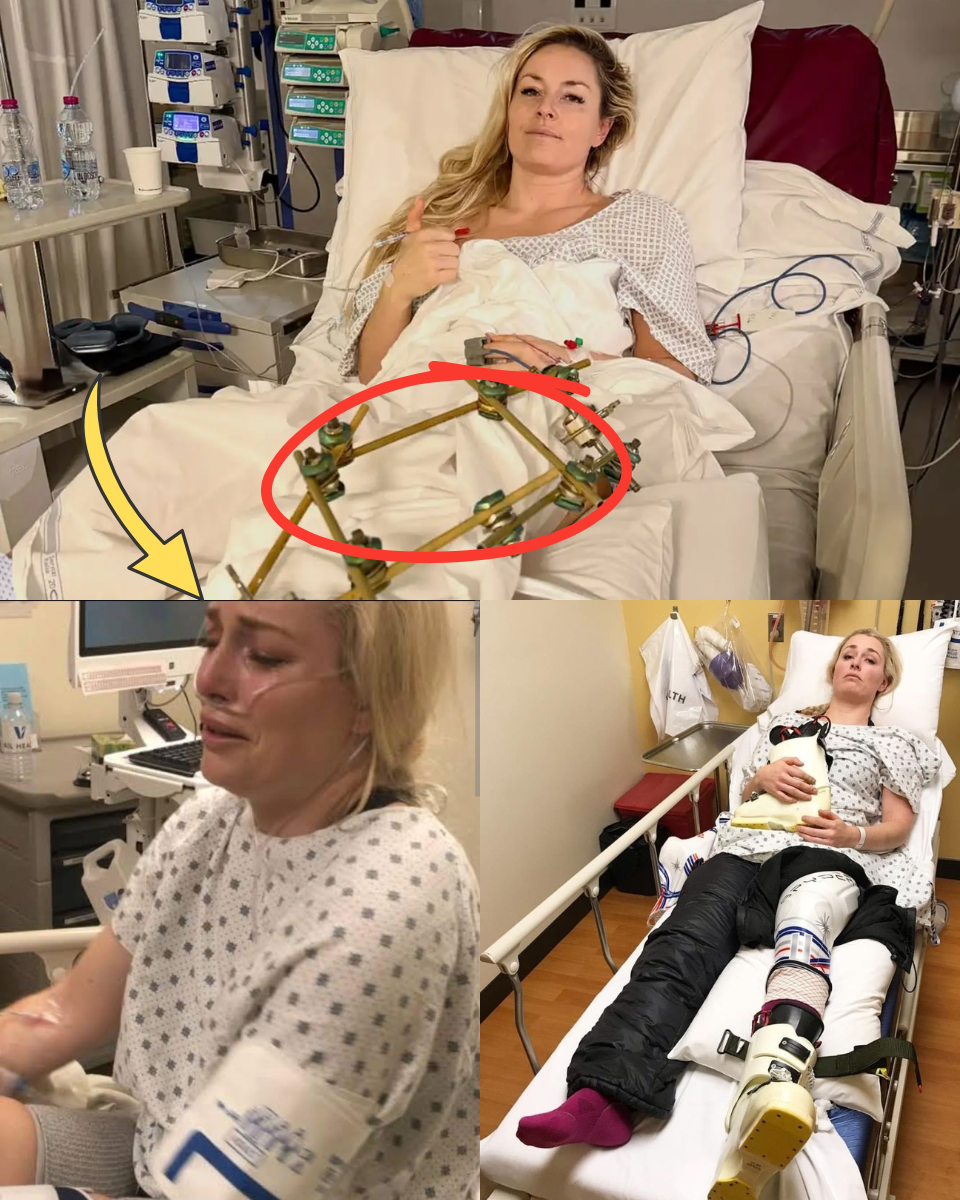 THE MOST PAINFUL NEWS: Lindsey Vonn accepts her PERMANENT EXIT?