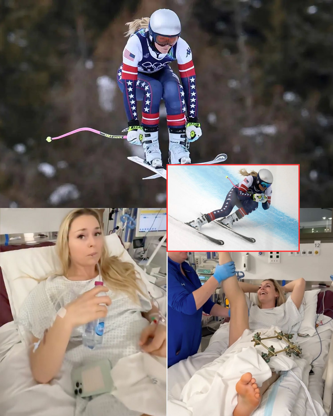 Lindsey Vonn has pushed back at critics who labeled her “selfish” for claiming an Olympic berth while dealing with a torn ACL