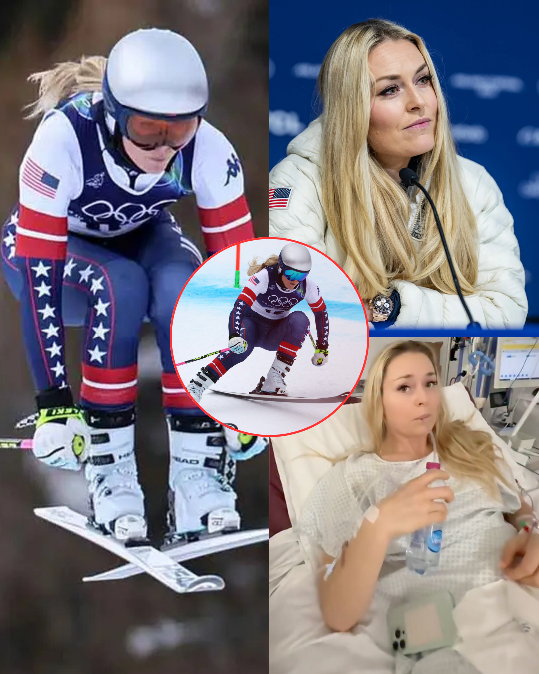 Facing backlash over her Olympic qualification with a torn ACL, Lindsey Vonn has sharply criticized those branding her “selfish”