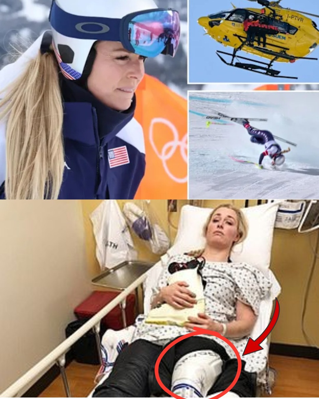 Lindsey Vonn reveals the real reason behind her ACL injury at the Olympics