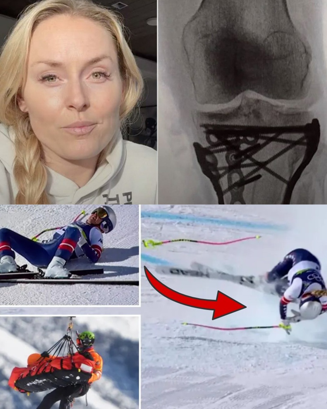 Recalling the dark day at the Olympics, Lindsey Vonn moved fans to tears as she revealed the traumatic period she went through after the accident