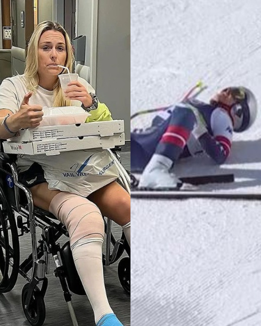 Silence fell over the ski village as NBC replayed the final footage of Lindsey Vonn’s injury. Amidst prayers from colleagues like Sofia Goggia, attention focused on a brief moment in the videoโa detail doctors believed held the key to understanding her true condition