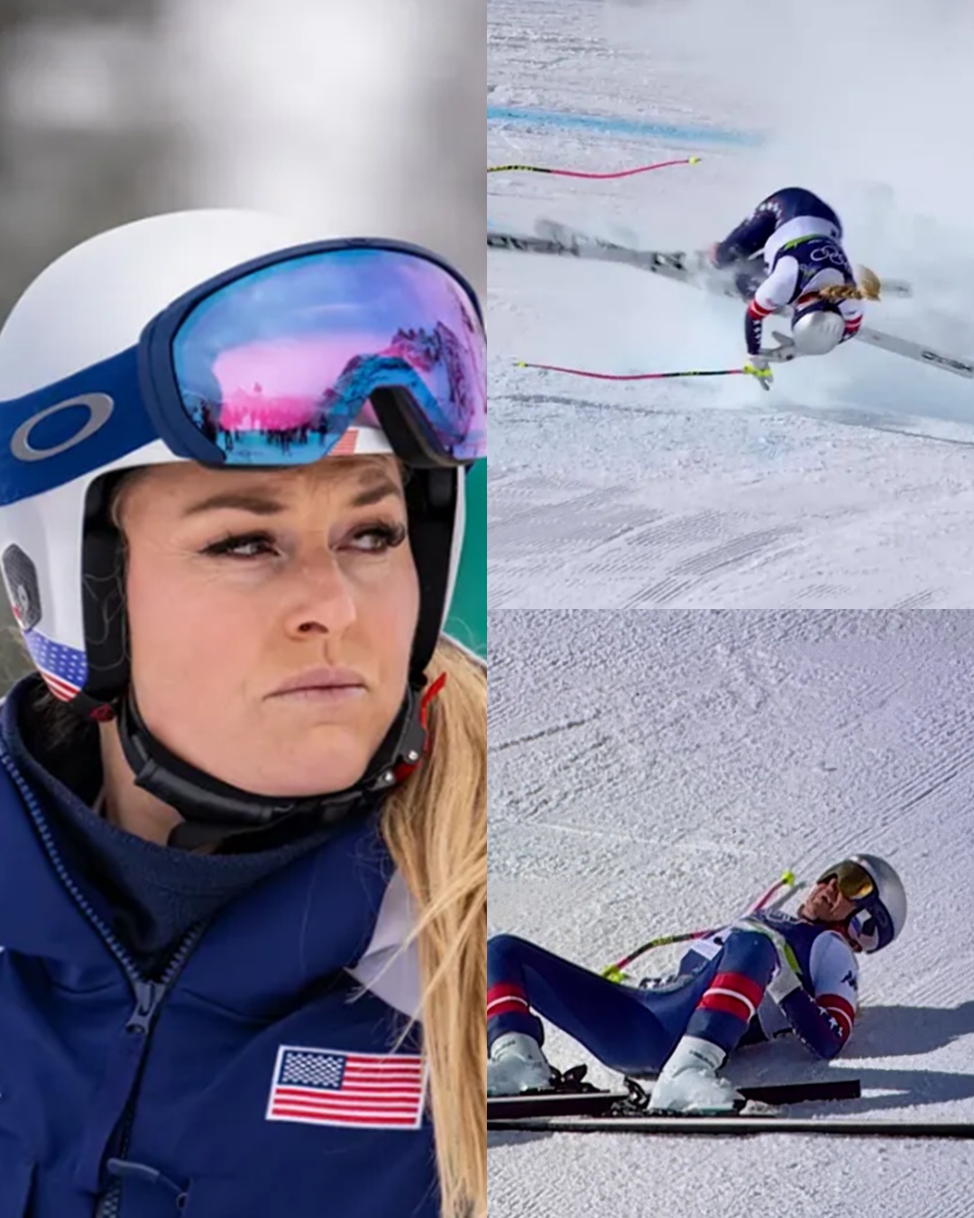 Despite enduring intense physical pain, Lindsey shared on social media that she had “no regrets.” She affirmed that simply being able to stand at the starting line again was a victory, and her spirit remained unbroken even though her Olympic dream ended after just 13 seconds