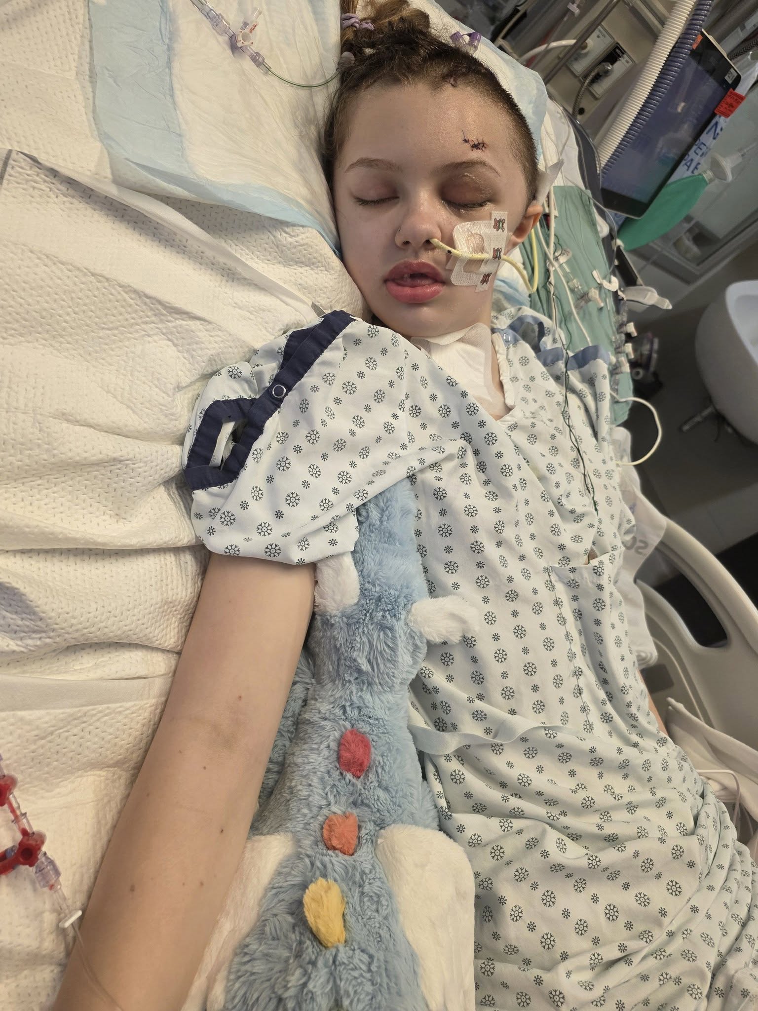 LATEST UPDATE – A heart-wrenching moment in the intensive care unit: Little girl just had her breathing tube removed to try breathing on her own — her reaction brought the whole family to tears…