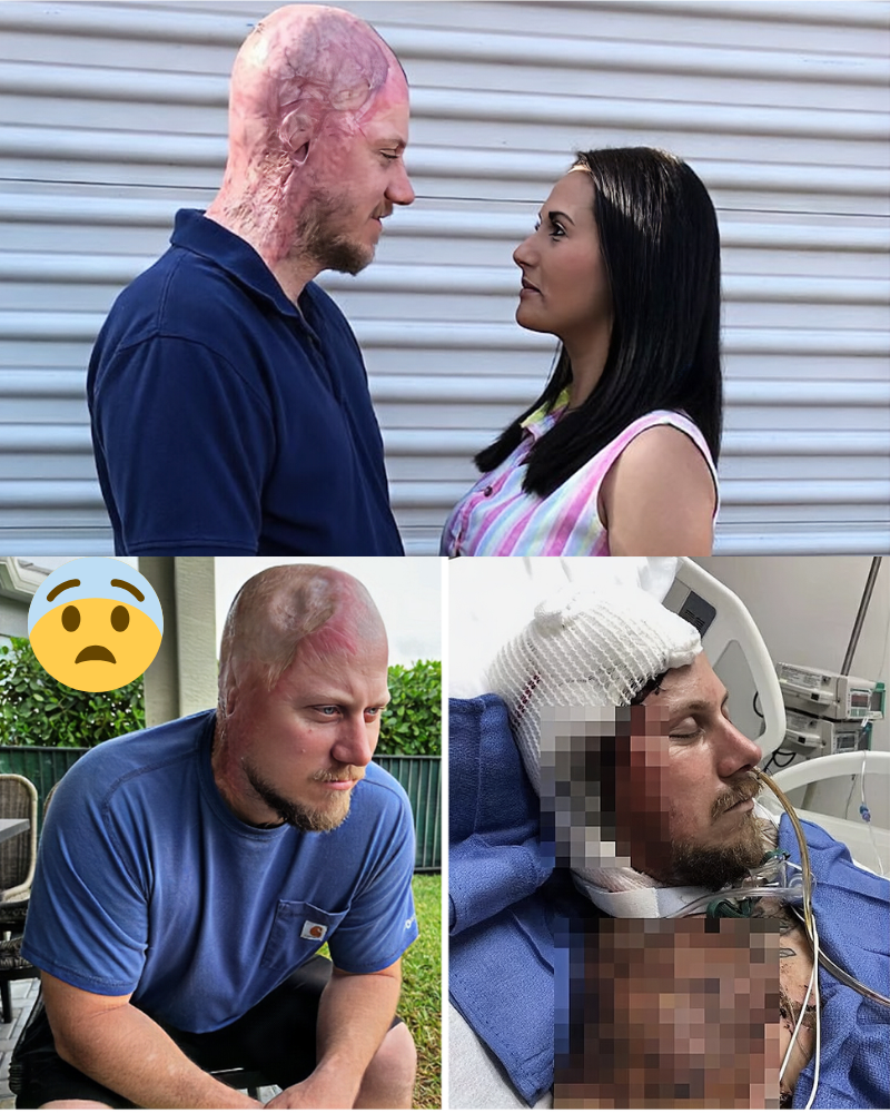 SH0CK: Electric current goes through he@d – doctors thought he wouldn’t su-rvi-ve – A father of two in Florida une-xpecte-dly sur-viv-ed a hor-rif-ic accident, leaving many in di-sbelief, all thanks to this one method…