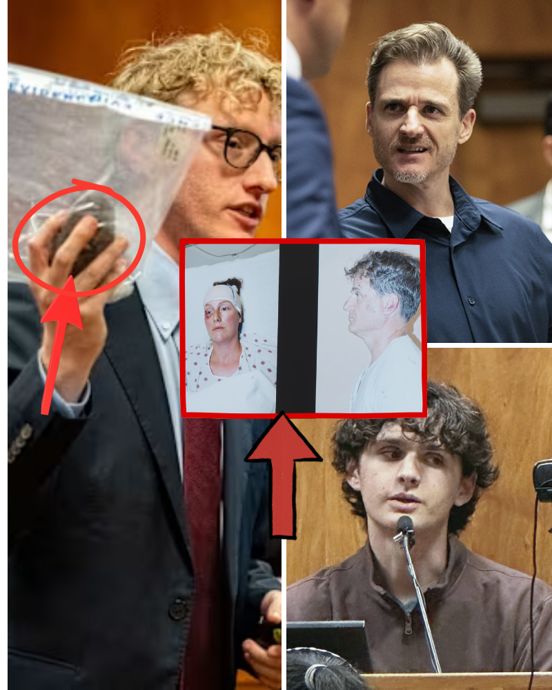 The details in the medical records โ the time of injury, the force of impact, the prior signs โ ALL SIDED THE JUDGMENT TOWARDSโฆ